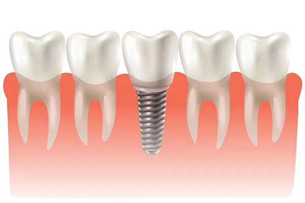 Jain Dental Care & Implant Centre