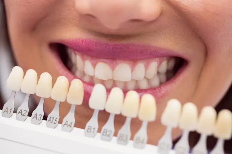 Cosmetic Dentist in Raipur